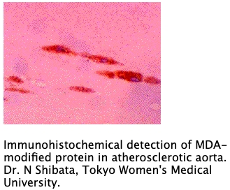 Anti MDA monoclonal antibody