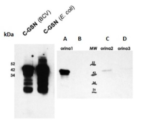 Mouse Anti-GSN (Gelsolin isoform A) monoclonal antibody