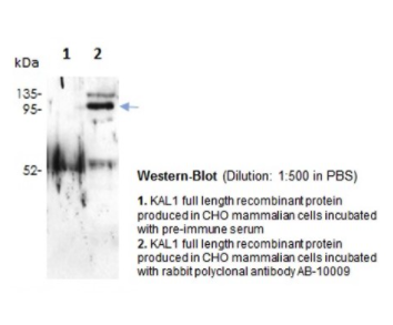 Rabbit Anti-KAL1 (Anosmin 1) polyclonal antibody