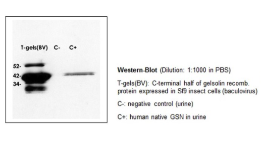 Rabbit anti-GSN (Gelsolin isoform A) polyclonal antibody