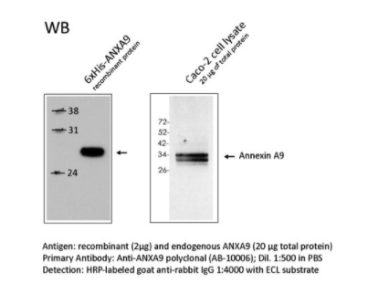 Rabbit Anti-ANXA9 (Annexin A9) polyclonal antibody