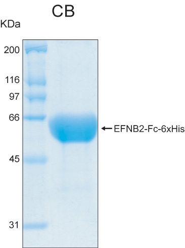 Human EFNB2 extracellular domain recombinant protein