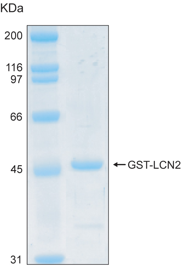 Human LCN2 (Lipocalin 2) recombinant protein