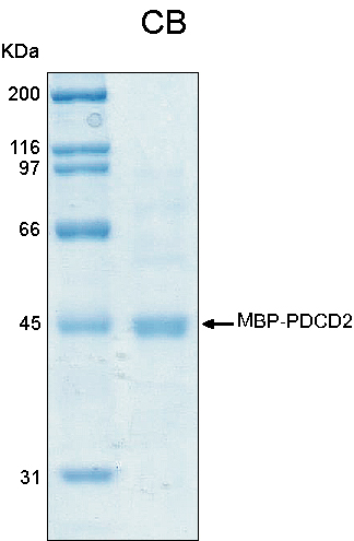 Human PDCD2 recombinant protein