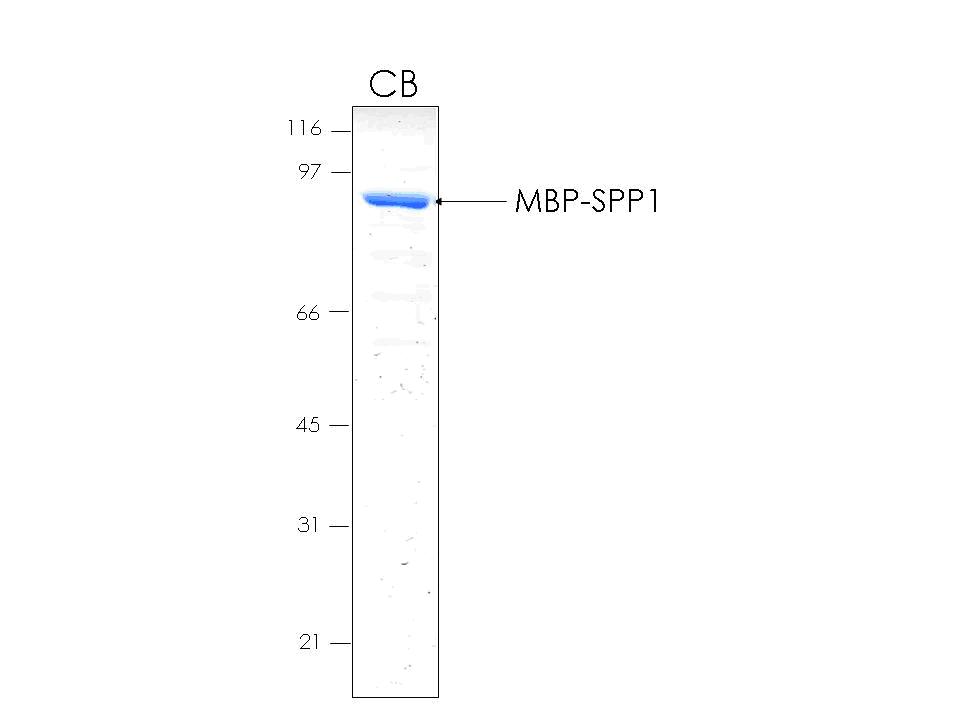 Human SPP1 (Osteopontin) recombinant protein with MBP