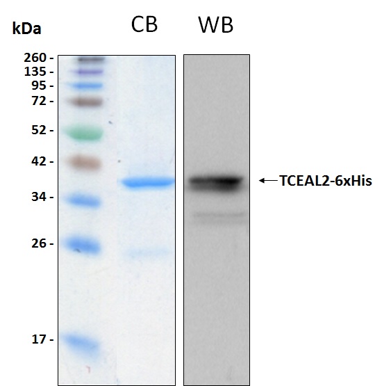 Human TCEAL2 recombinant protein