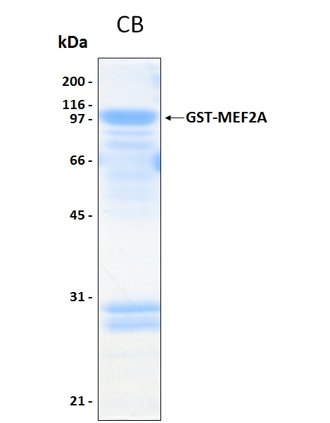 Human MEF2A recombinant protein