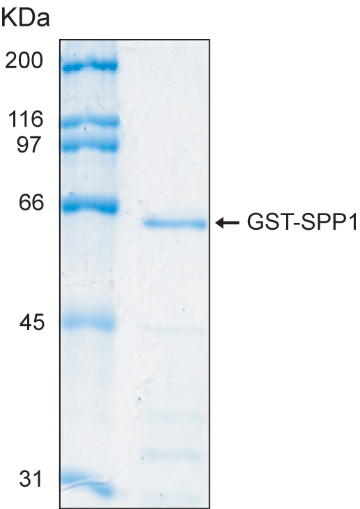 Human SPP1 (Osteopontin) recombinant protein with GST