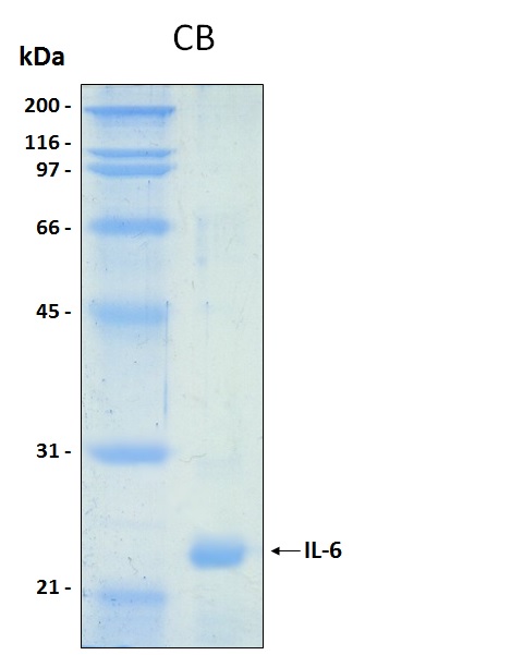 Human IL6 (Interleukin 6) recombinant protein without tag