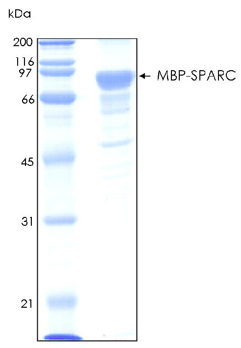 Human SPARC (Osteonectin) recombinant protein