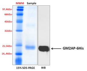 Human GM2AP recombinant protein