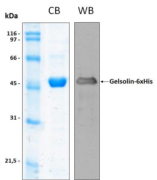 Human GSN C-terminal half (aa 404-782) recombinant protein
