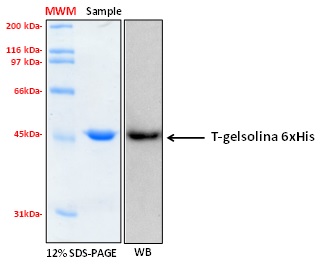 Human GSN C-terminal half (aa 404-782) recombinant protein