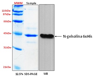 Human GSN N-terminal half (aa 1-403) recombinant protein