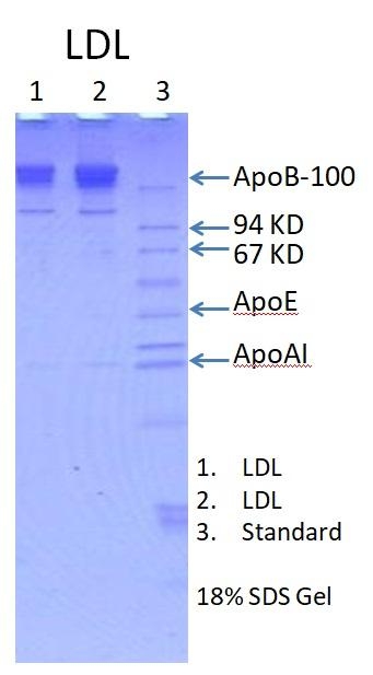人低密度脂蛋白 Human Low Density Lipoprotein(LDL)