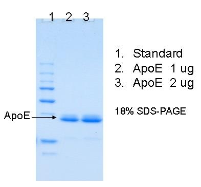 Human Apolipoprotein E(Apo E)人载脂蛋白E