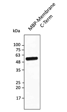Anti-Membrane Protein (SARS-CoV-2) Antibody